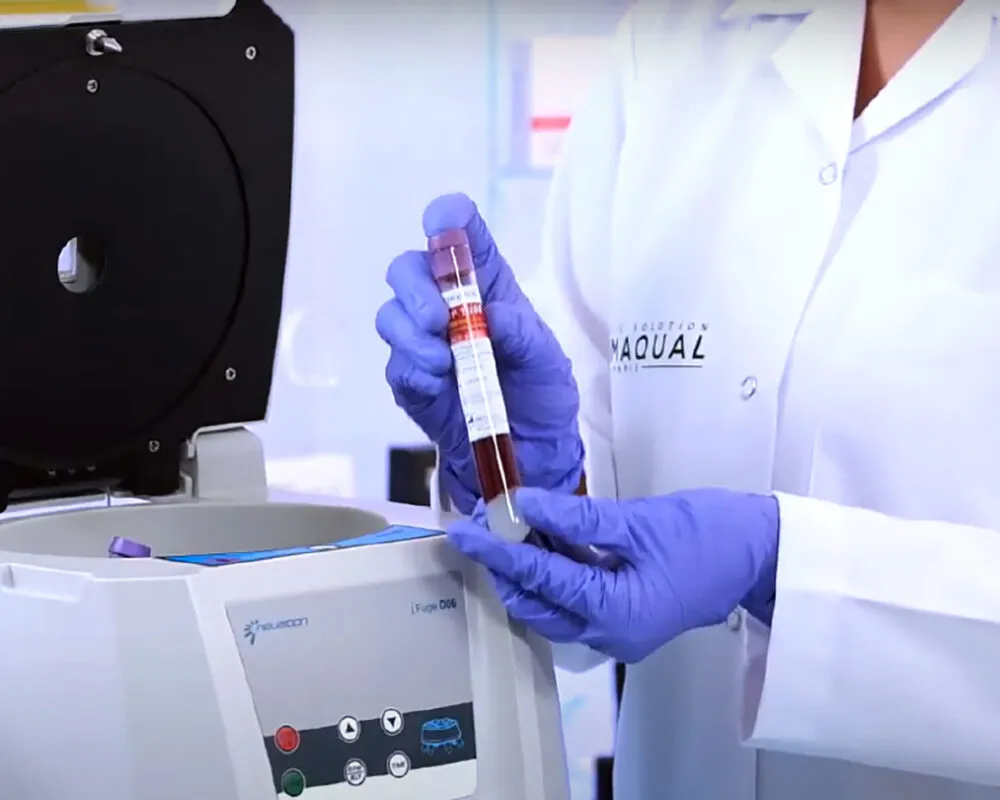 Professional handling a PRP tube beside a centrifuge
